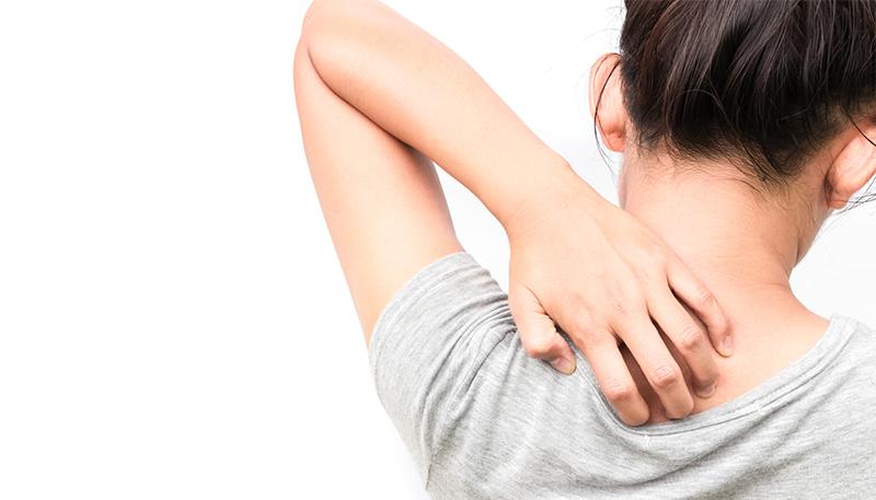 【2021年最新】アトピー性皮膚炎の新薬と開発状況を解説！