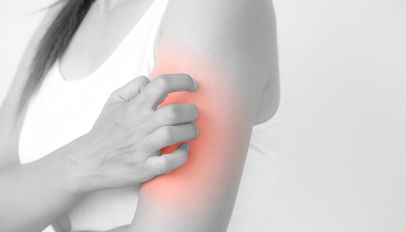 帯状疱疹に悩む患者さまへの対処方法は？治療方法や市販薬の有無も解説 