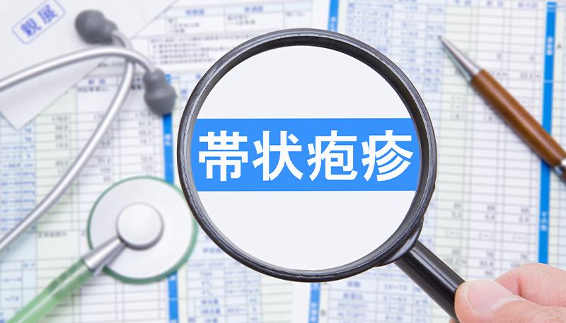 帯状疱疹の治療方法